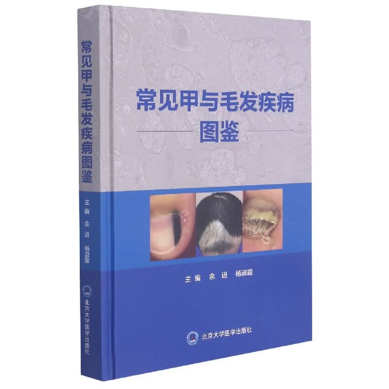 常见甲与毛发疾病图鉴(精)