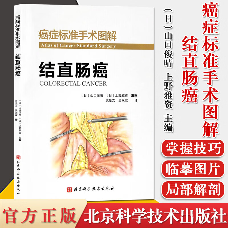 癌症标准手术图解/结直肠癌/结直肠癌流行病学病因生理病理发病机制/临床表现及诊/断鉴别诊断书籍k/