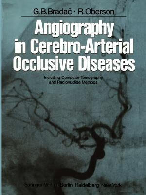 预订angiography in cerebro-arterial occlusive diseas