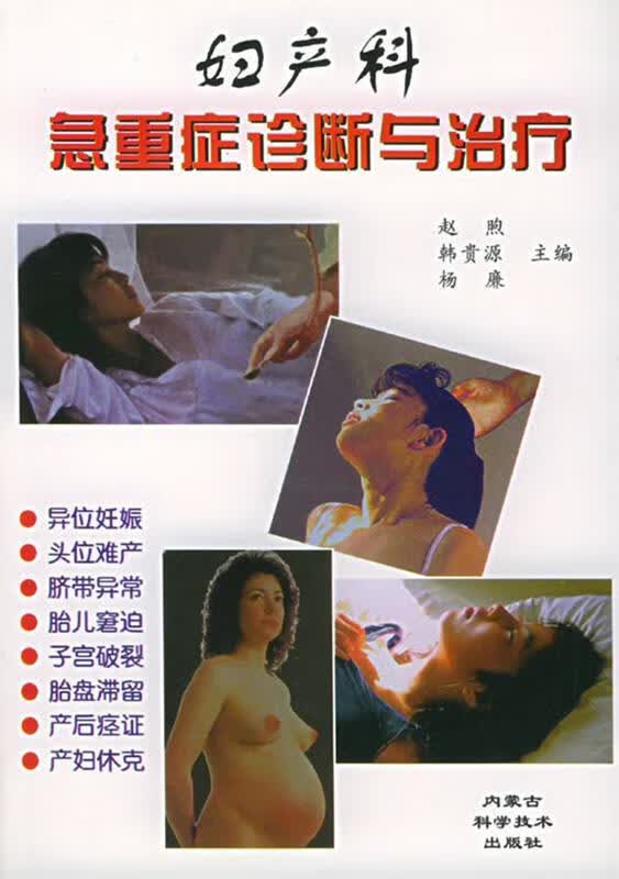妇产科急重症诊断与治疗 赵煦,韩贵源,杨廉【正版】
