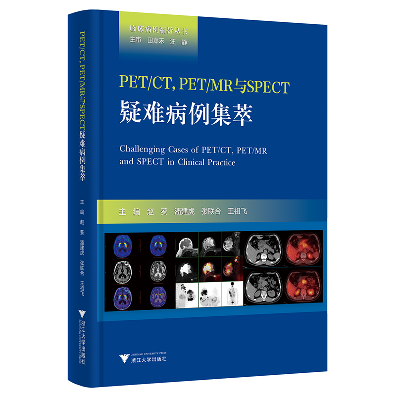 PET/CT,PET/MR与SPECT疑