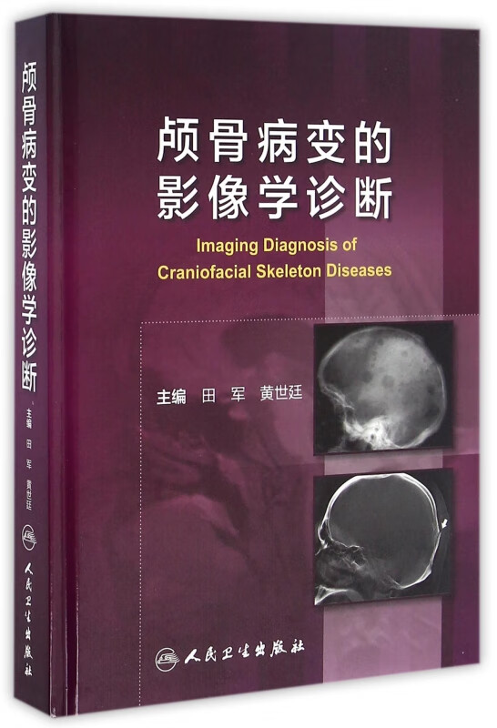 颅骨病变的影像学诊断(精)