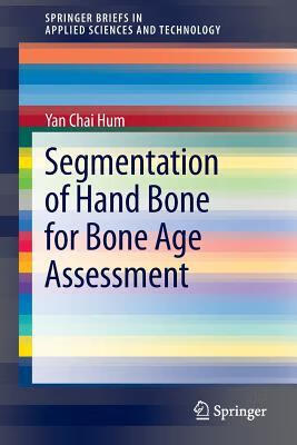 预订Segmentation of Hand Bone for Bone Age Assessmen