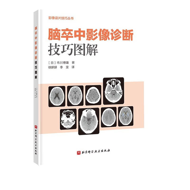 脑卒中影像诊断技巧图解  脑部脑卒中影像诊断影像ct读片mri技巧 脑部