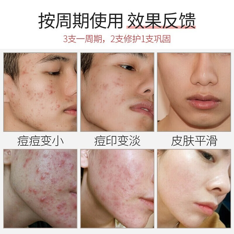 匠医师匠医师南京同仁堂祛痘印修复淡化痘印痘坑修复凹洞淡化痘印痘疤