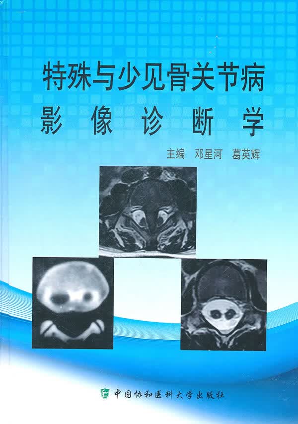 特殊与少见骨关节病影像诊断学【正版图书】
