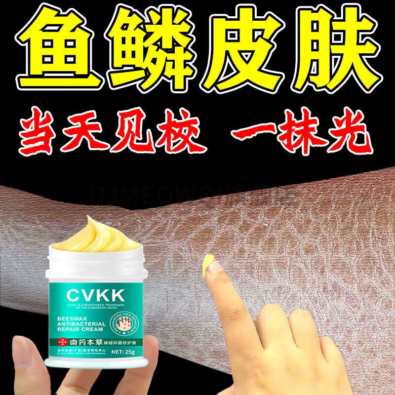 干鸡皮皮肤(鸡皮皮肤是什么) 干鸡皮皮肤(鸡皮皮肤是什么)