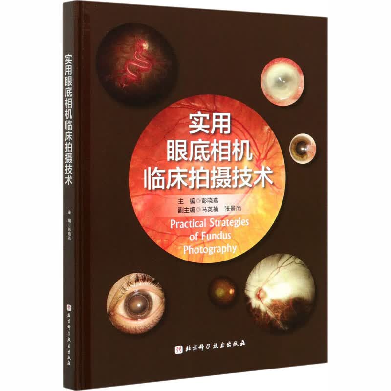 实用眼底相机临床拍摄技术