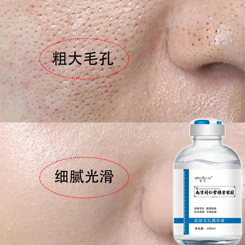 beauty notes毛孔收敛精华液毛孔粗大修复毛孔男女士面部收缩毛孔精华液100ML