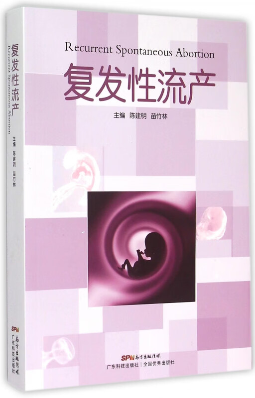 复发性流产