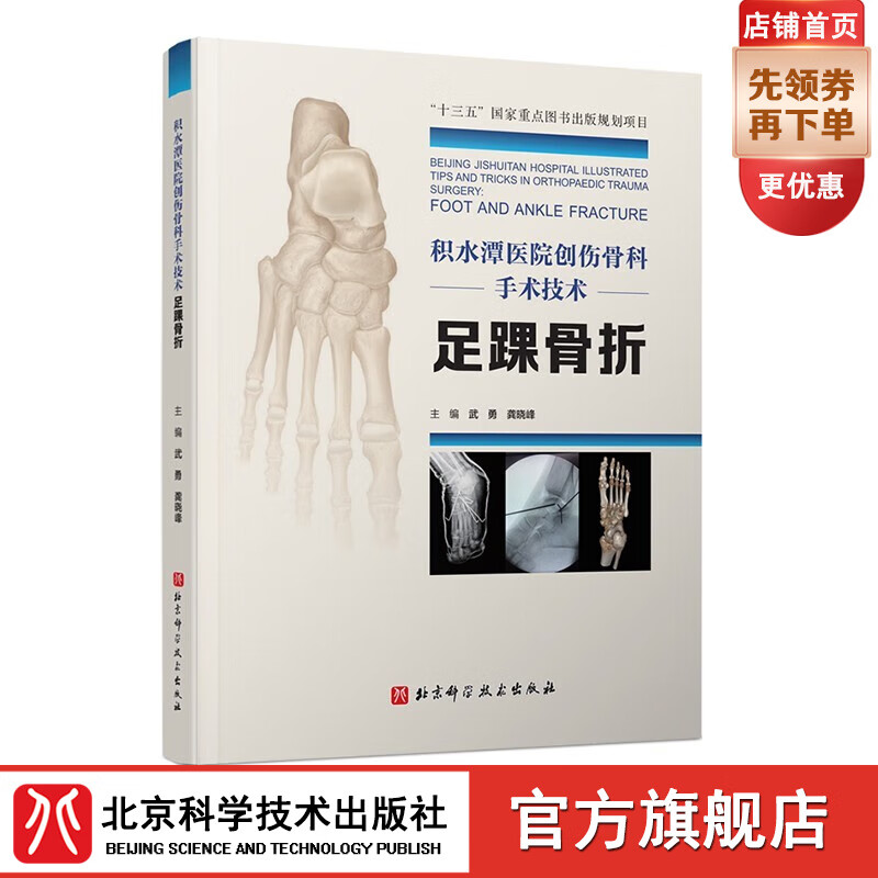 积水潭医院创伤骨科手术技术 足踝骨折 北京积水潭医院手术经验全景展示 北京科学技术