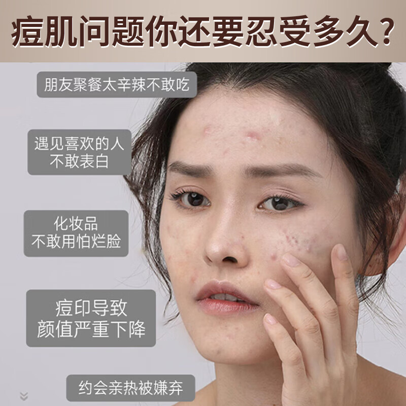 润凰德德维芙皮傲宁胶态硫祛痘膏去痘印痘坑修复青春痘壬二酸15%凝胶