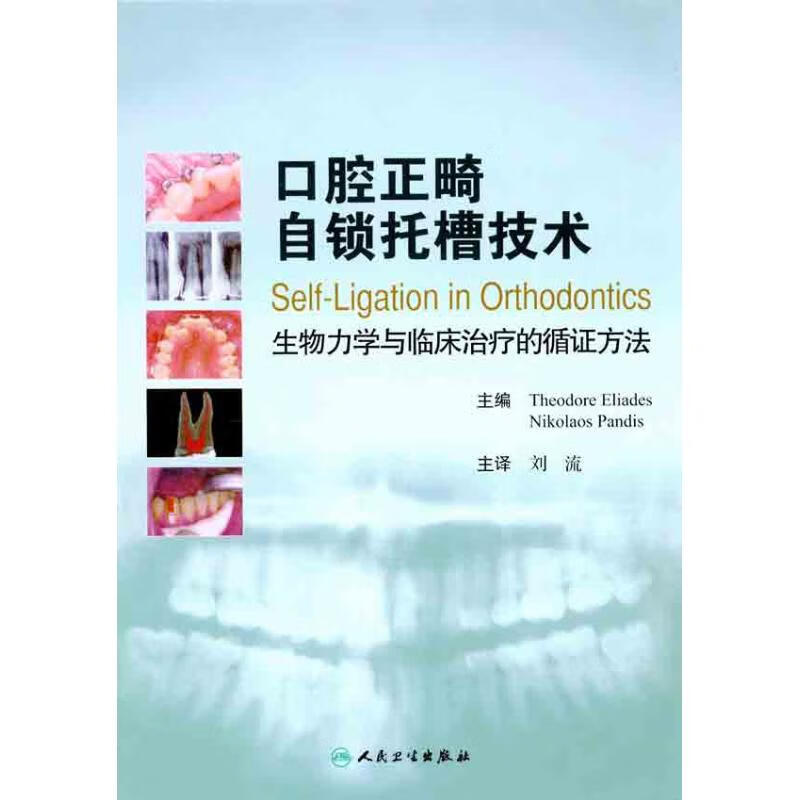 口腔正畸自锁托槽技术 生物力学与临床治疗的循证方法