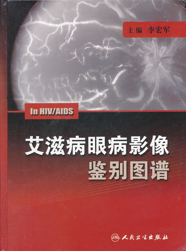 眼病影像鉴别图谱【正版图书】