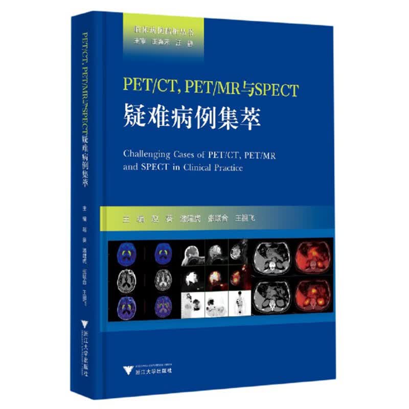 PETCT PETMR与SPECT疑难病例集萃/临床病例精析丛书