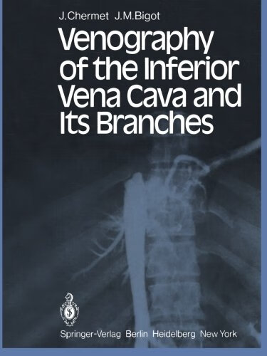 预订 venography of the inferior vena cava and its branches