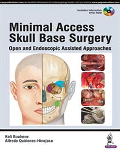 预订Minimal Access Skull Base Surgery: Open and Endo
