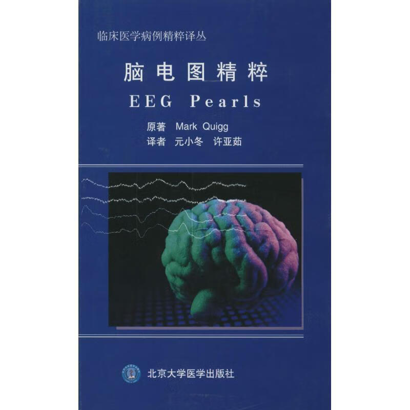 脑电图精粹【正版好书，下单速发】