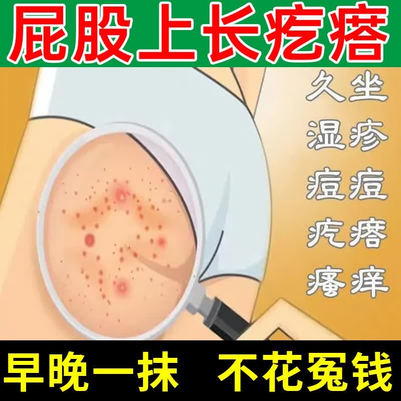 屁股上长疙瘩治成人久坐屁股长痘痘湿疹毒疙瘩红肿疼屁股疼屁股痒大腿