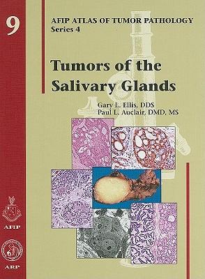 预订tumors of the salivary glands