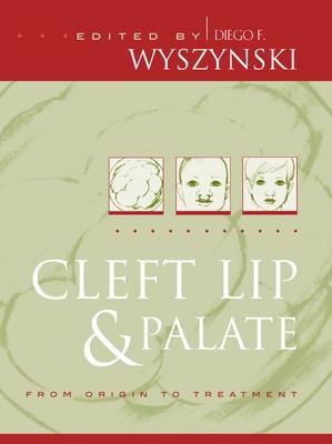 预订cleft lip and palate: from origin to treatment