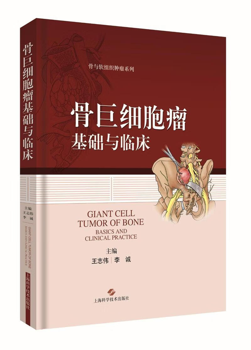 骨巨细胞瘤基础与临床  大中专教材教辅  王志伟  上海科学技术出版社