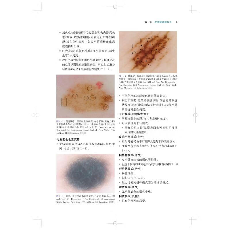 皮肤镜诊断精要与图解 图书