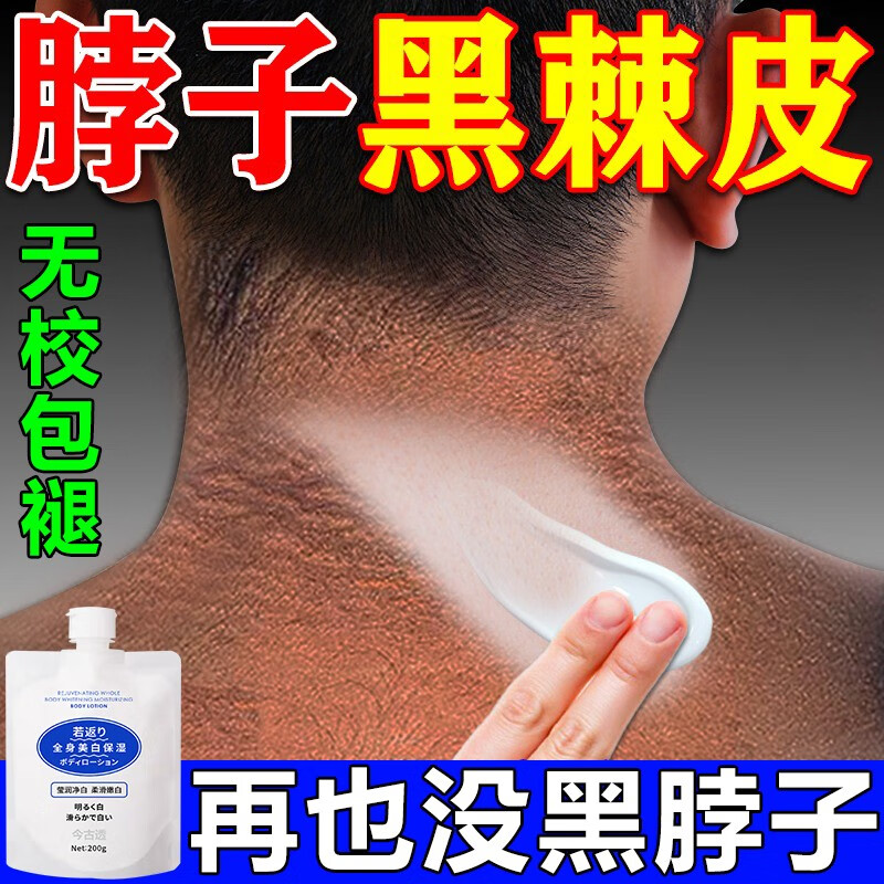 黑棘皮病治脖子黑色素黑棘皮病脖子黑黑的去l黑色素沉淀洗不干净 单