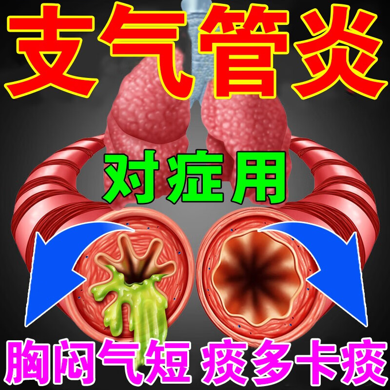 支气管炎磁疗贴咳嗽止咳贴平药化痰肺气肿慢阻肺化痰专 1盒[干咳久咳]
