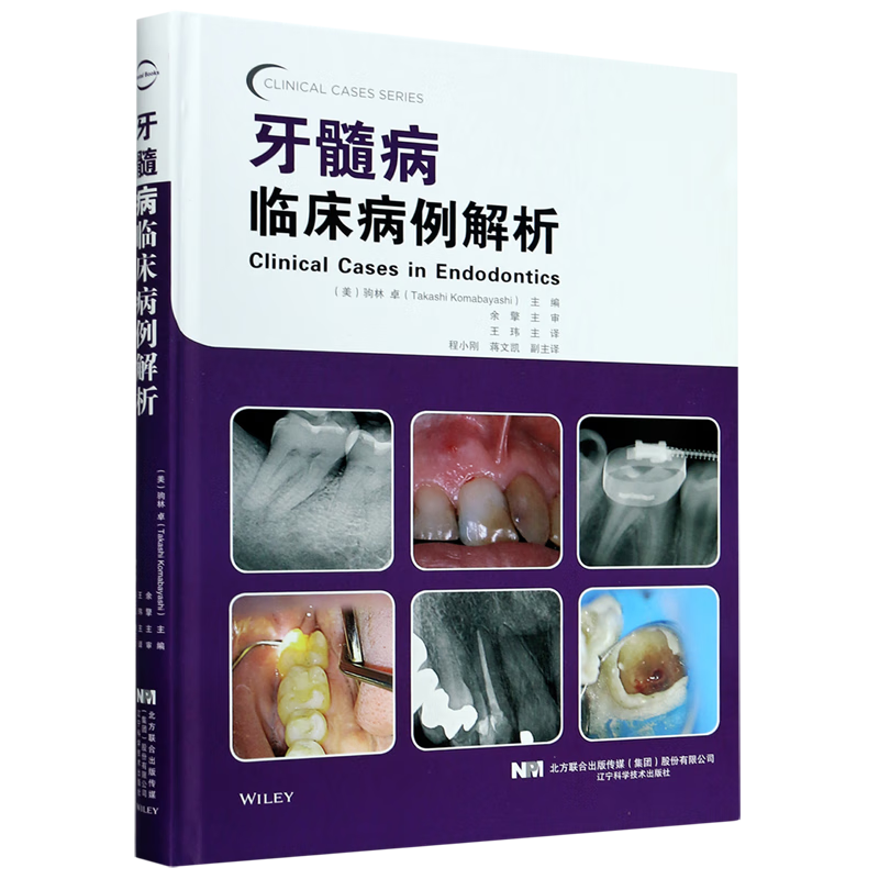 牙髓病临床病例解析(精)