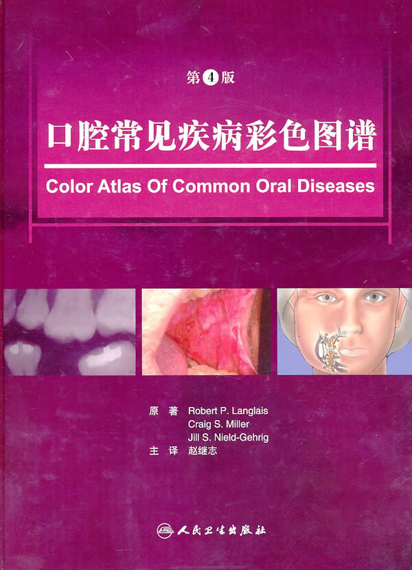 口腔常见疾病彩色图谱第4版 罗伯特