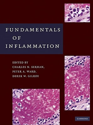 预订 fundamentals of inflammation