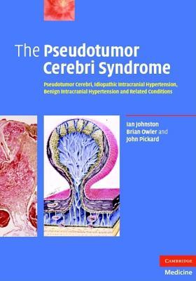 预订 高被引the pseudotumor cerebri syndrome: pseudotumo
