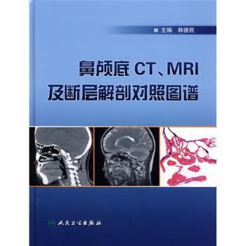 鼻颅底CT、MRI及断层解剖对照图谱 韩德民 9787117098717