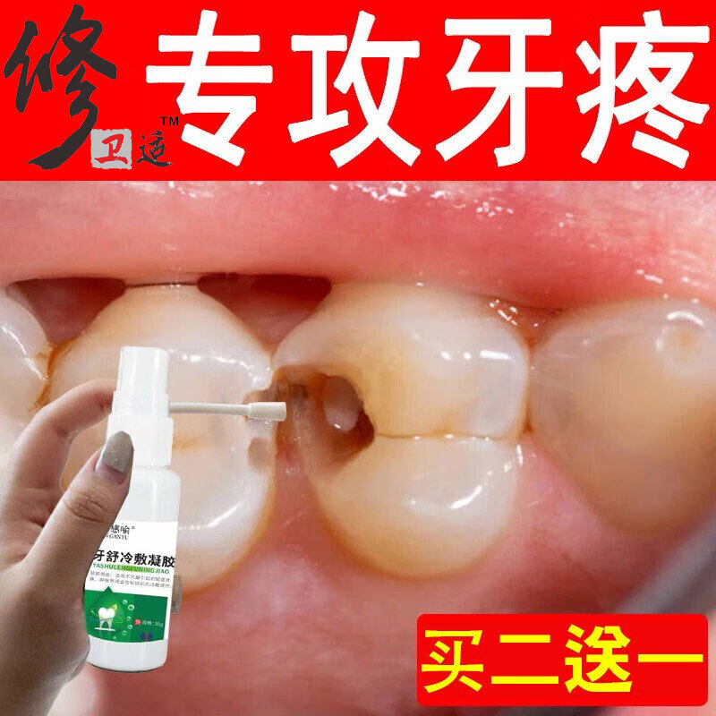 修卫适 牙痛喷剂牙龈肿痛上火儿童牙周神经疼牙痛宁蛀牙疼喷雾牙