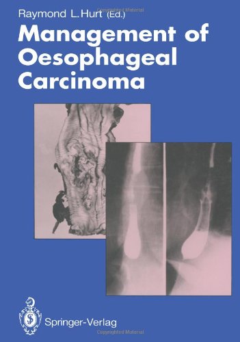 预订 management of oesophageal carcinoma