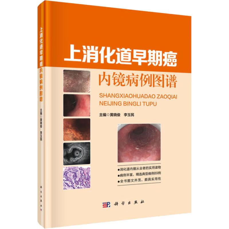 上消化道早期癌內镜病例图谱