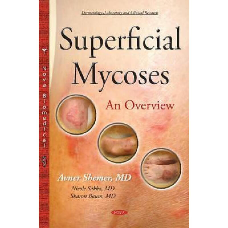 预订 superficial mycoses - an overview  *author t.