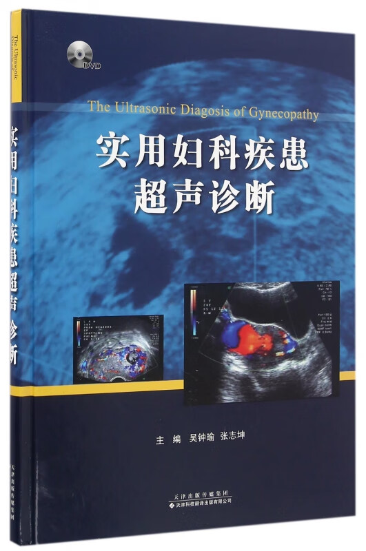 实用妇科疾患超声诊断(附光盘)(精)