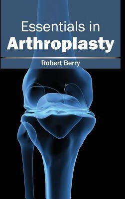 预订Essentials in Arthroplasty