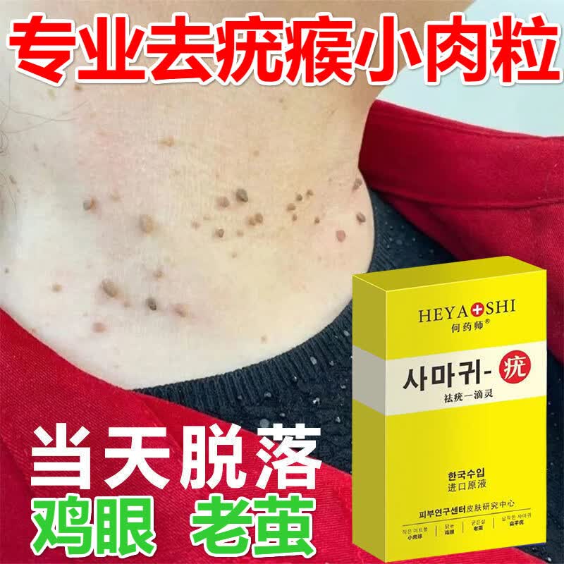 1盒装【1-2处轻度疣体】进口原液