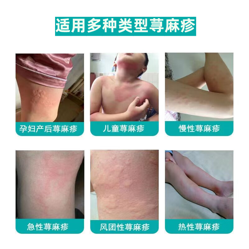 儿童成人中药泡澡包产后寻全身宝宝药浴包