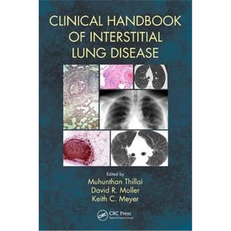 预订clinical handbook of interstitial lung disease