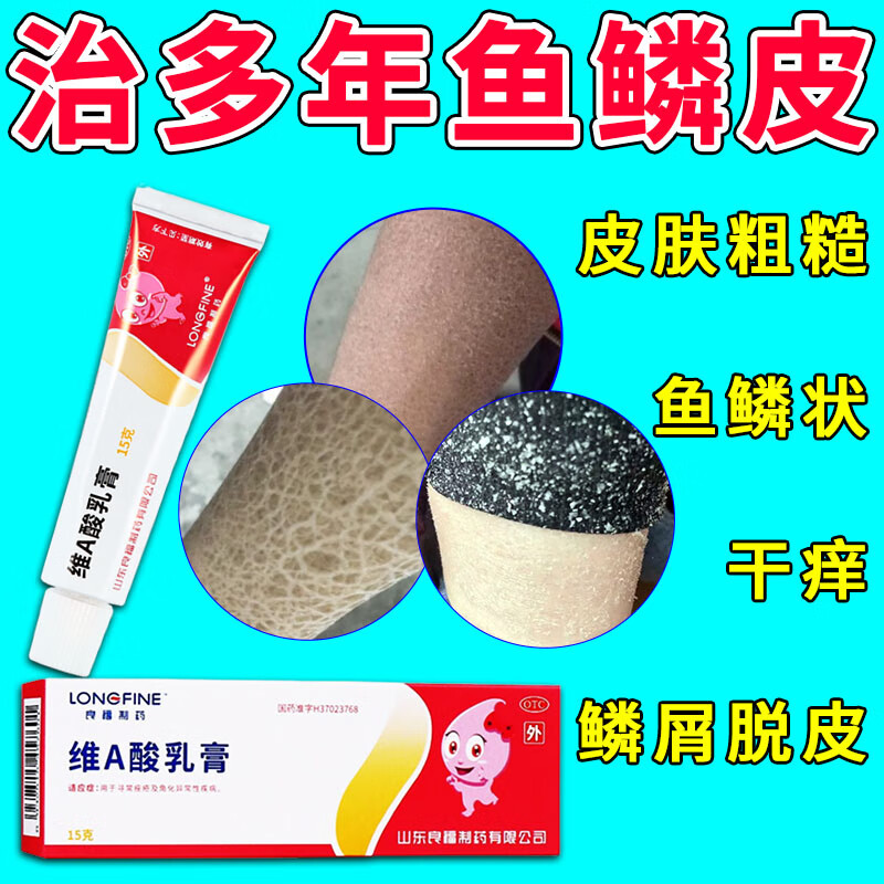 治干燥脱屑鱼鳞肤鳞状掉皮粗糙瘙痒蛇皮鸡皮皮肤药膏 0