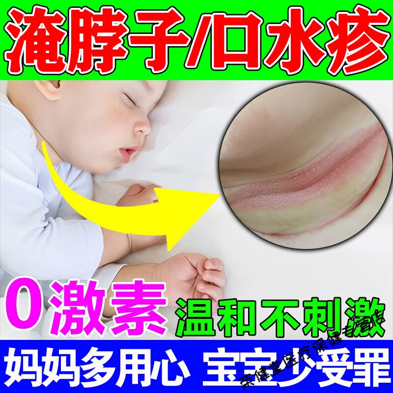 九督堂方神医湿痒清宝宝防淹脖子神器新生婴儿口水热疹膏腋下大腿根