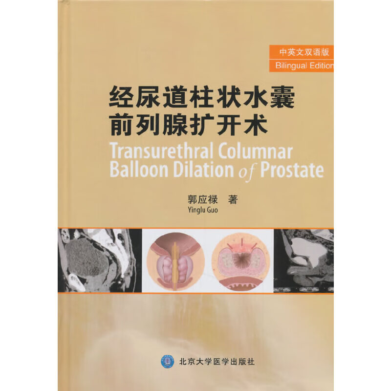 经尿道前列腺扩开术(2015北医)