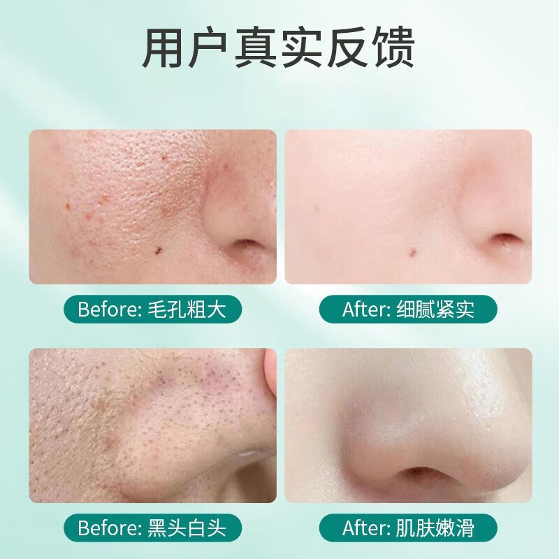 碧素堂（BISUTANG）【第二件￥10】BST洗面奶屈臣i氏乳糖酸黑头粉刺控油敏感肌洗面奶 1支装