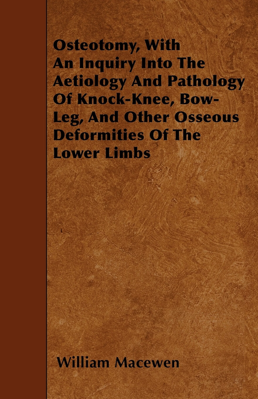 with an inquiry into the aetiology and pathology of knock-knee