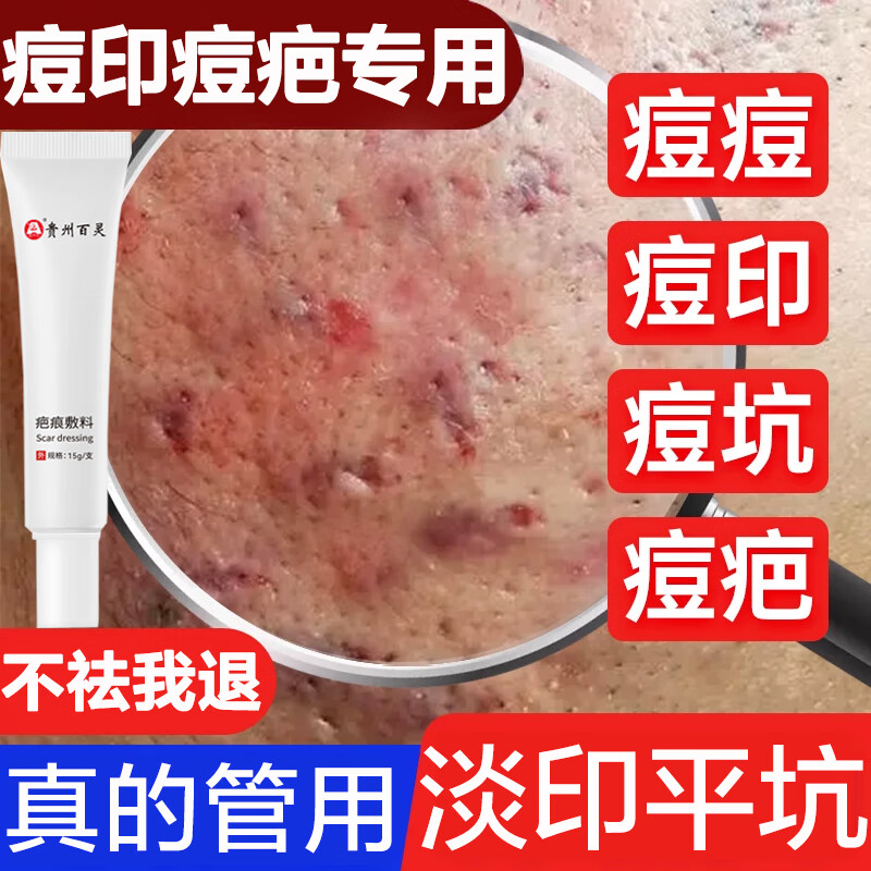 百灵鸟可搭祛痘膏去痘坑去痘疤痘印痘坑修护复凹洞黑色素沉淀淡化15g/支