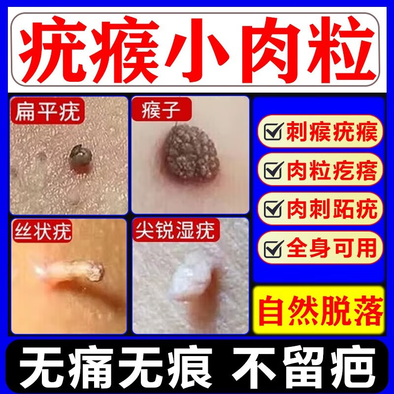 维a酸乳膏治扁平疣专用药膏面部脖子去用瘊子肉粒疙瘩除的小肉粒猴子